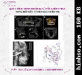 Free Image Hosting At https://www.hinhso.com